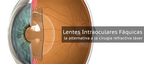 clnica baviera lente intraocular: precio|Precio Operación Presbicia